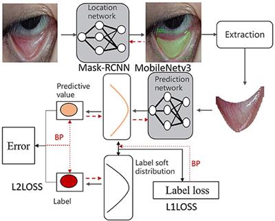 Two-stage hemoglobin prediction based on prior causality